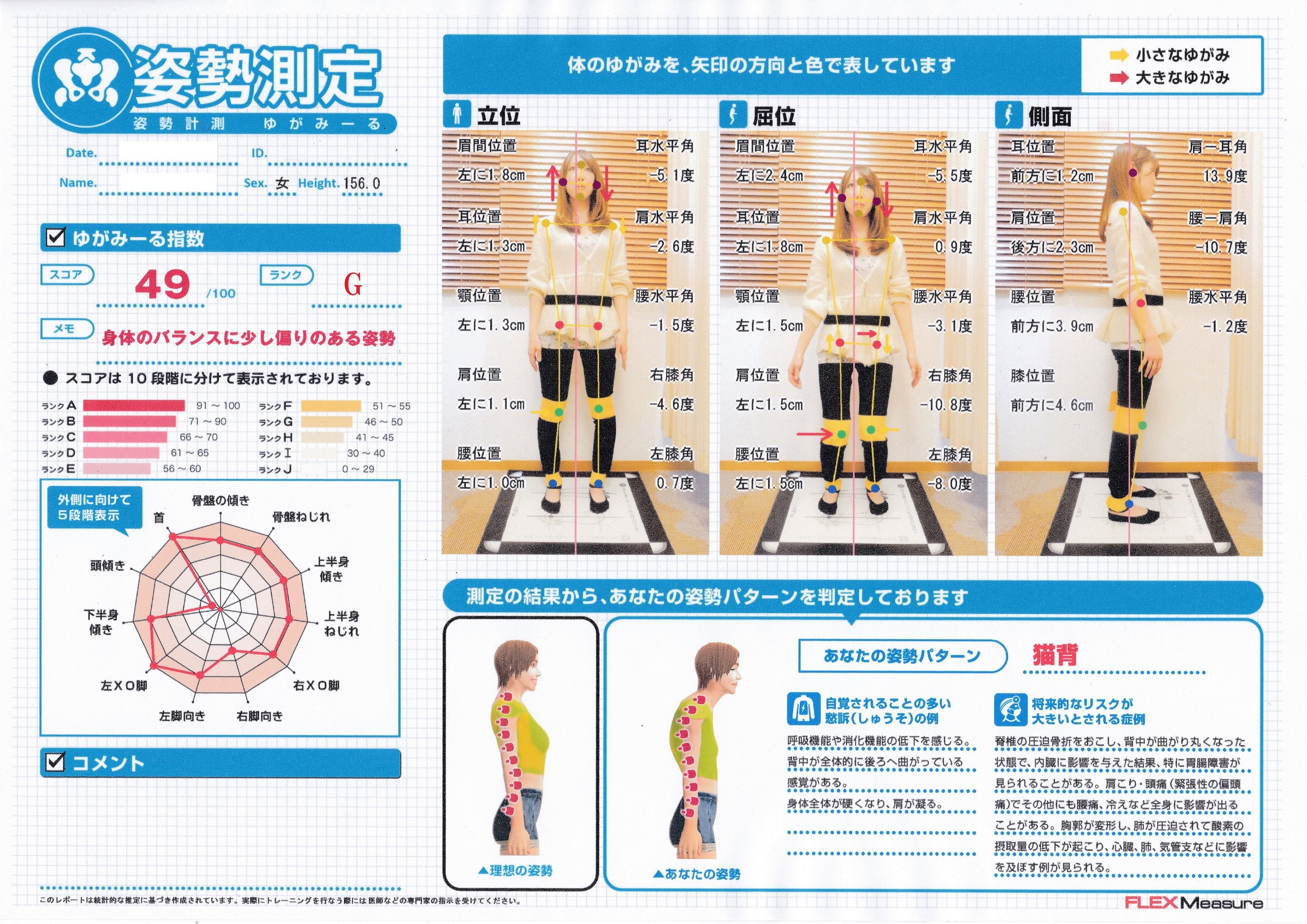 細かく姿勢分析をチェックできるのはおゆみ野、鎌取駅のセレネ整骨院